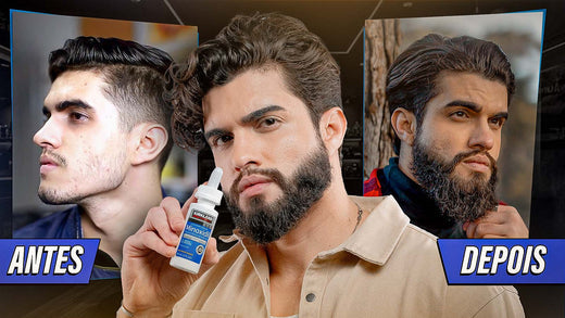 5 hábitos que vão fazer sua BARBA CRESCER com MINOXIDIL KIRKLAND 🧔🏻